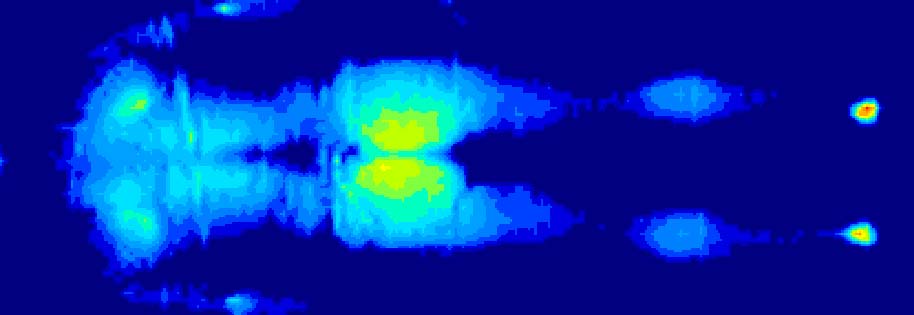 WoundCare Hospital Mattress Pressure Map